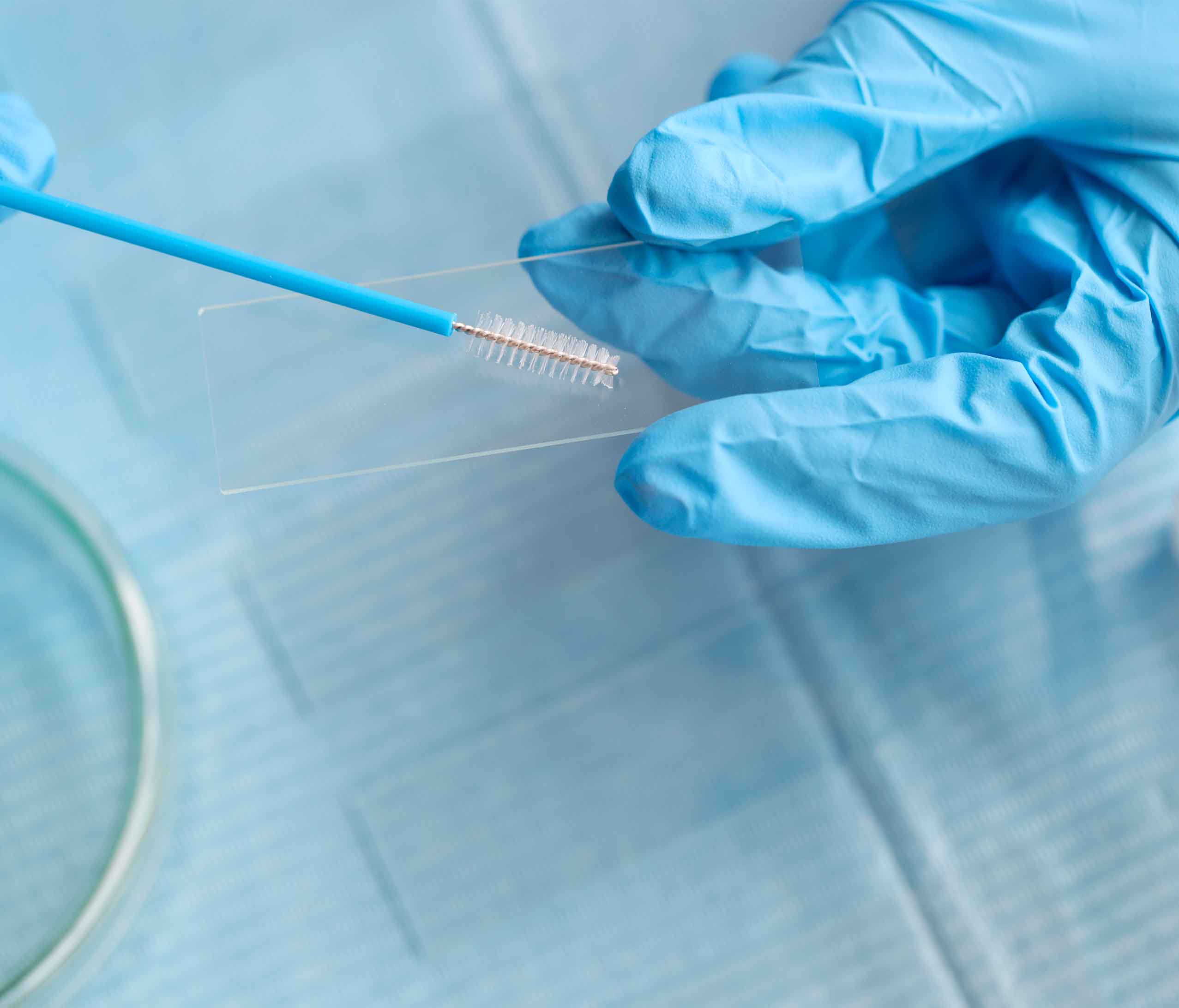 Especialista con cepillo para análisis de citología con guantes de látex color azul